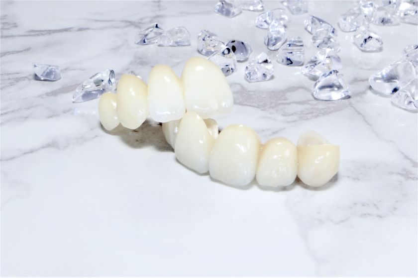 セレック治療の5つのメリット