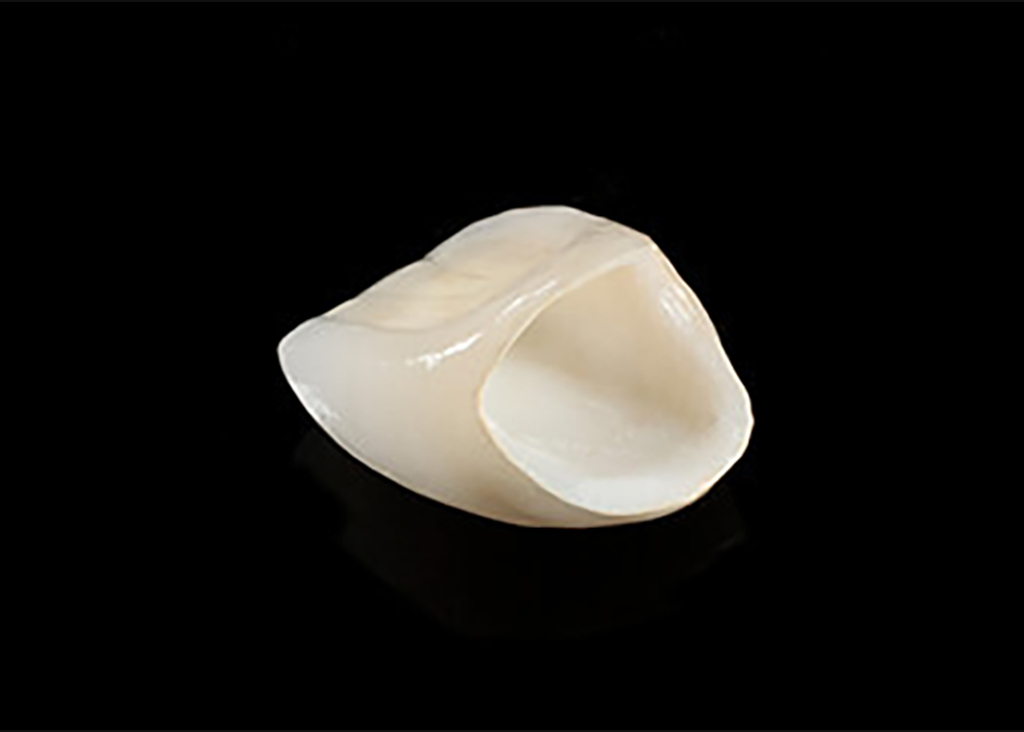 ジルコニアセラミック