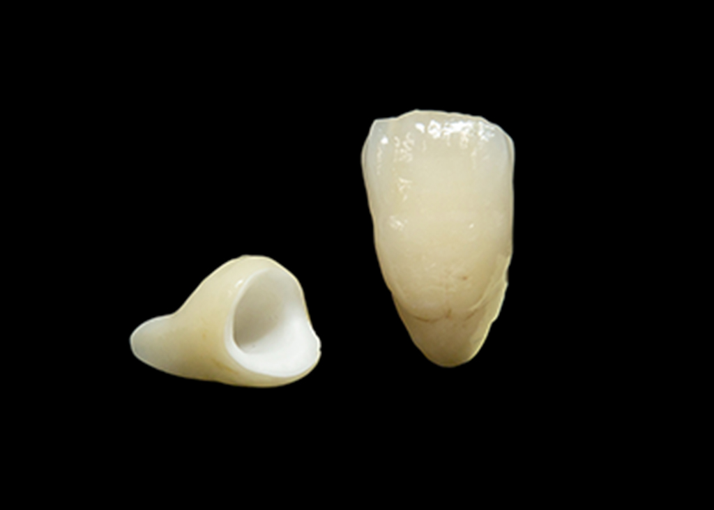 フルジルコニア