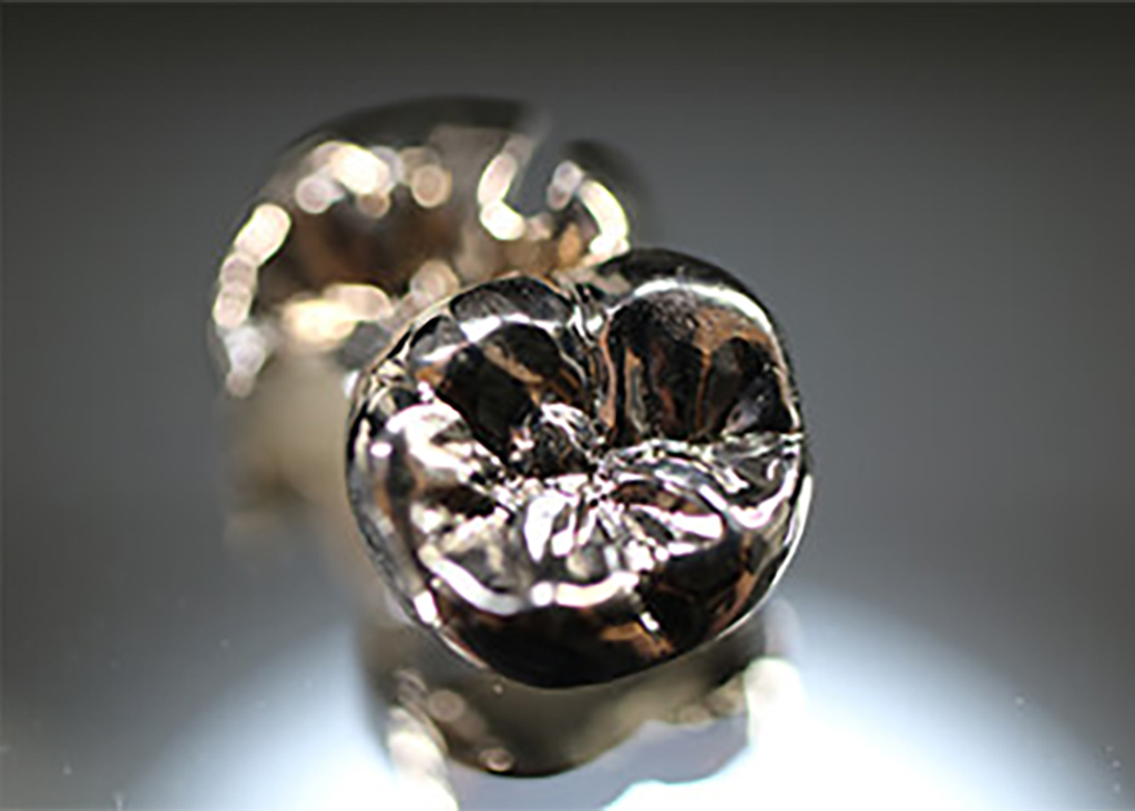 金銀パラジウム合金