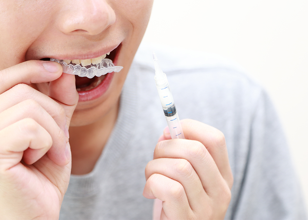 ホームホワイトニング