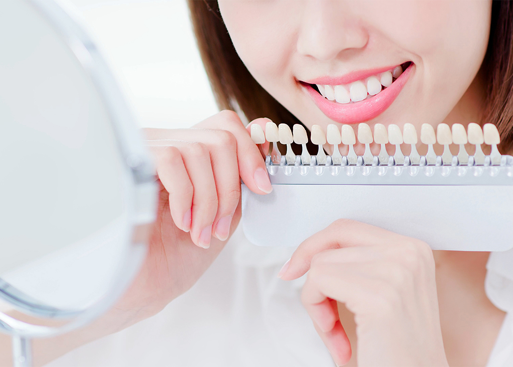 オフィスホワイトニング